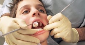 ارتودنسی دندان پوسیده