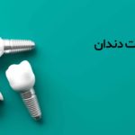 ایمپلنت دندان