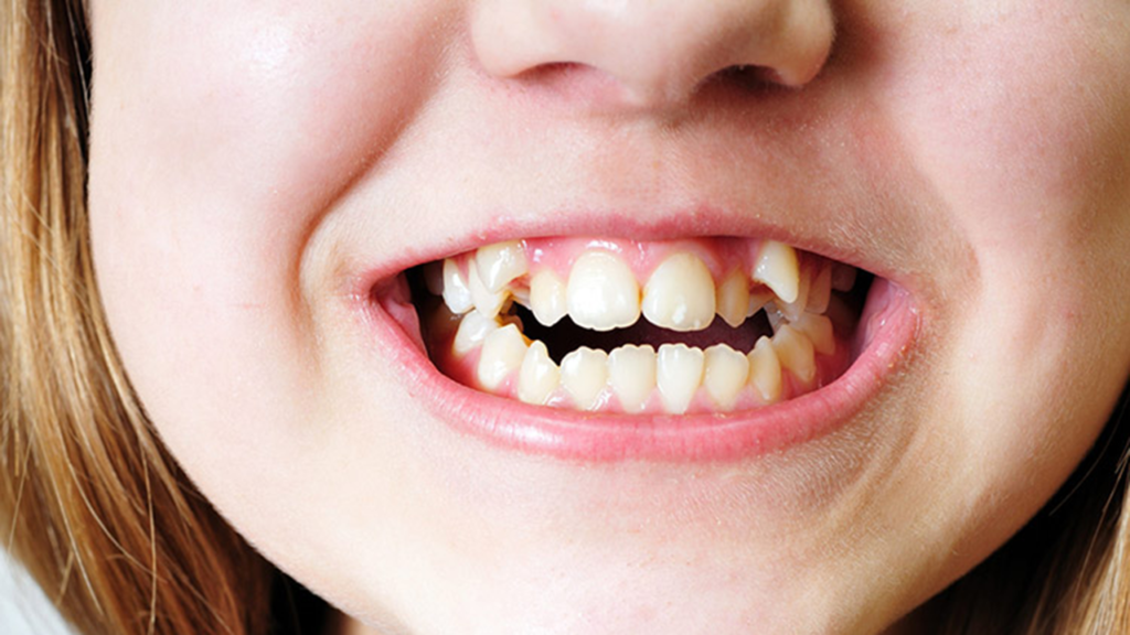 اهمیت دندان‌های منظم