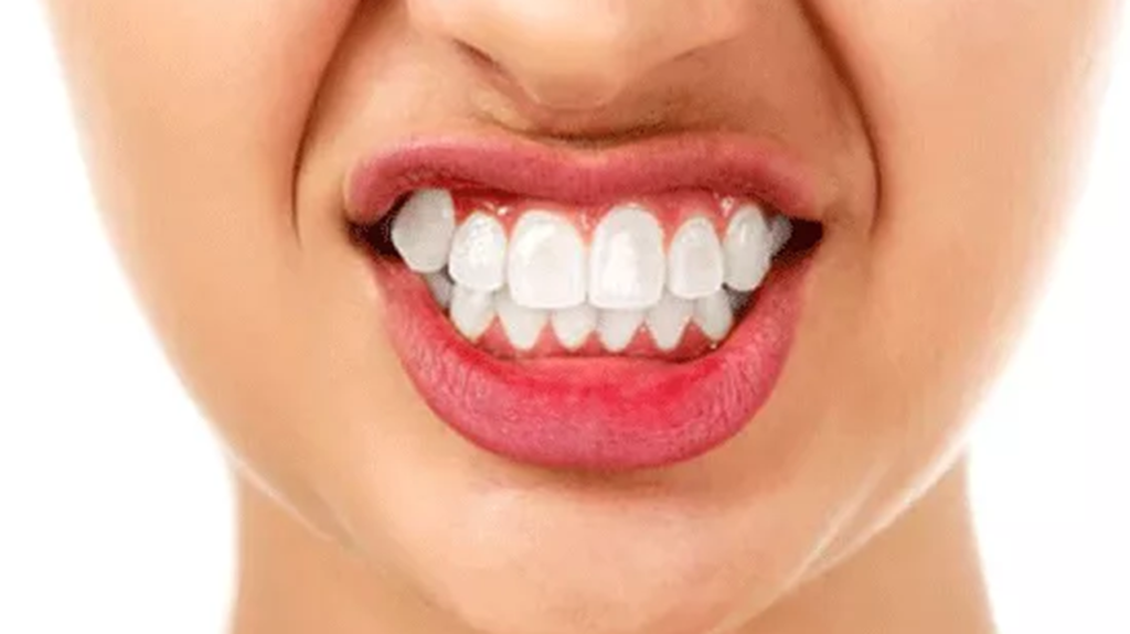 علت دندان‌های بزرگ