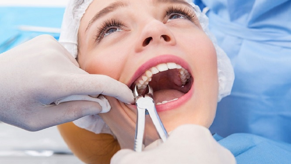 ارتودنسی با کشیدن دندان