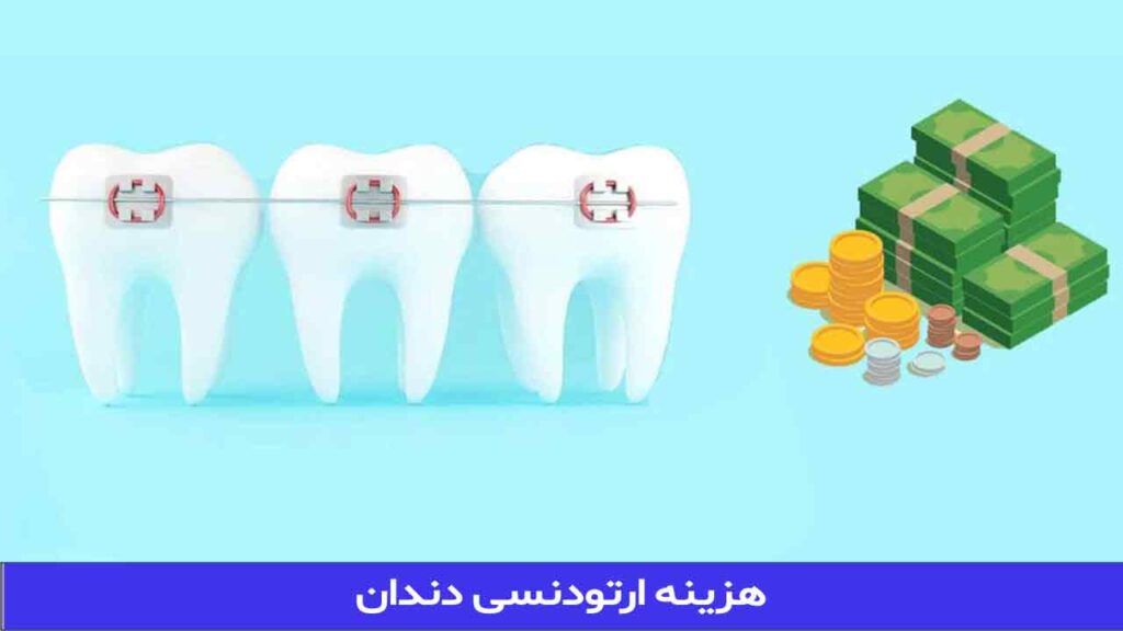 هزینه ارتودنسی دندان