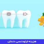 هزینه ارتودنسی دندان