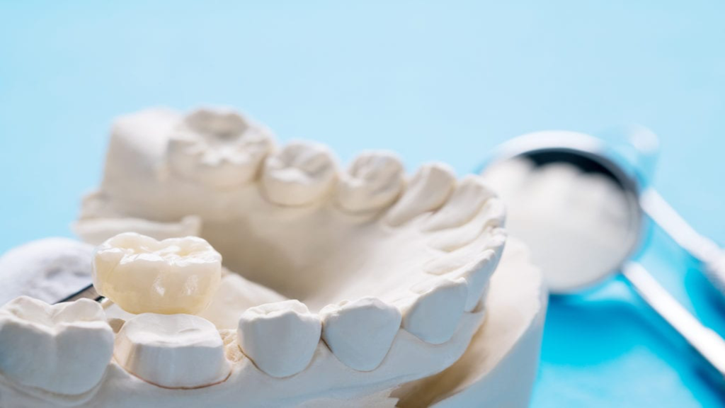 روکش دندان چیست؟