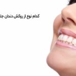 روکش دندان جلو