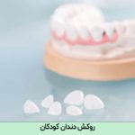 روکش دندان کودکان