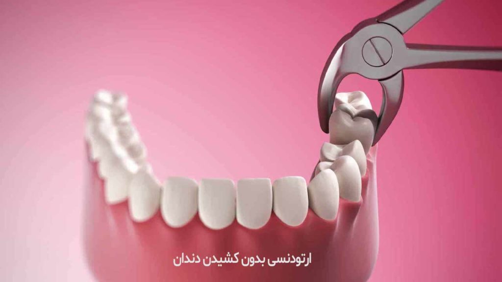 ارتودنسی بدون کشیدن دندان