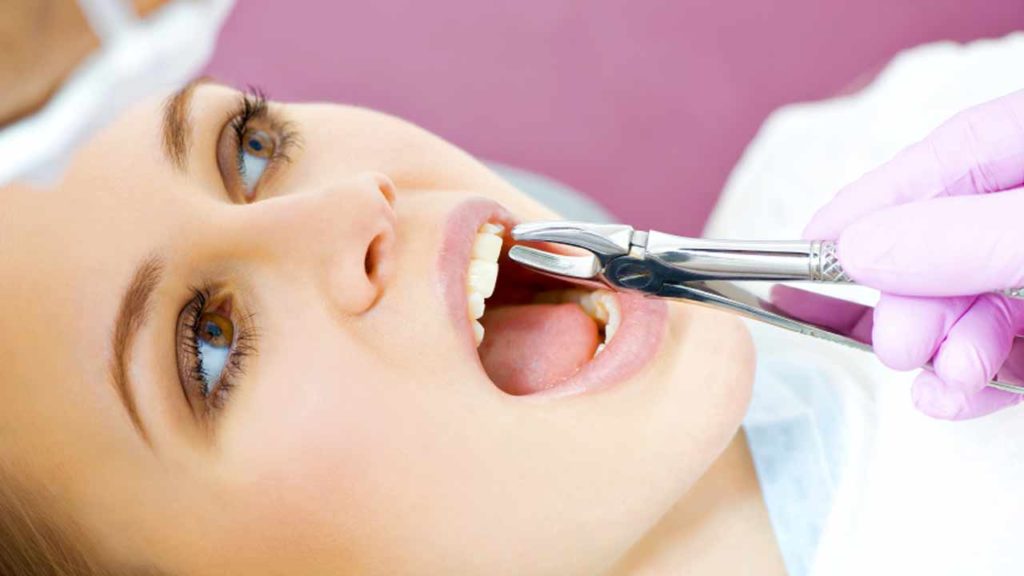 چند دندان برای درمان ارتودنسی برداشته می شود؟
