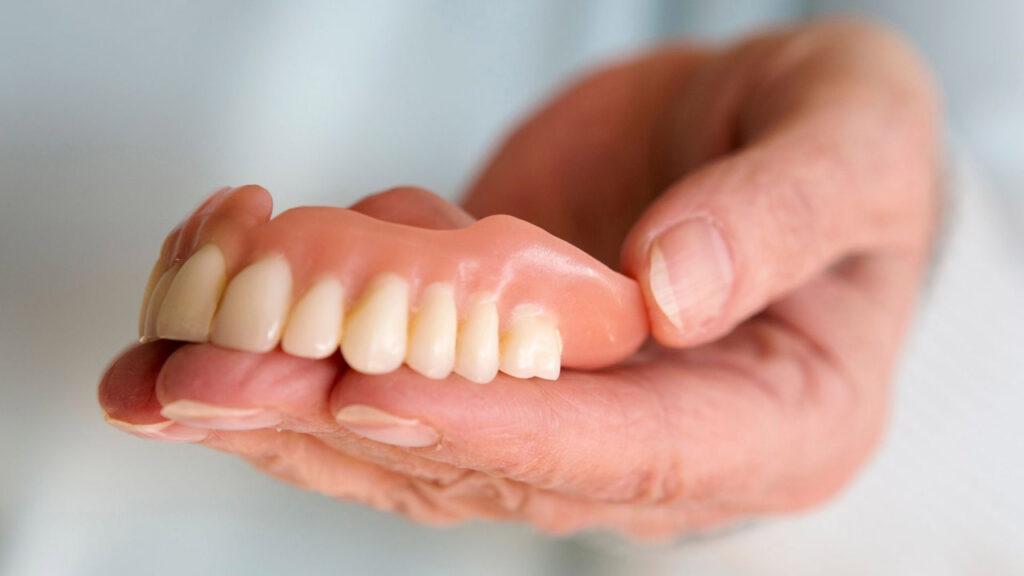 فرق بین دندان مصنوعی و ایمپلنت
